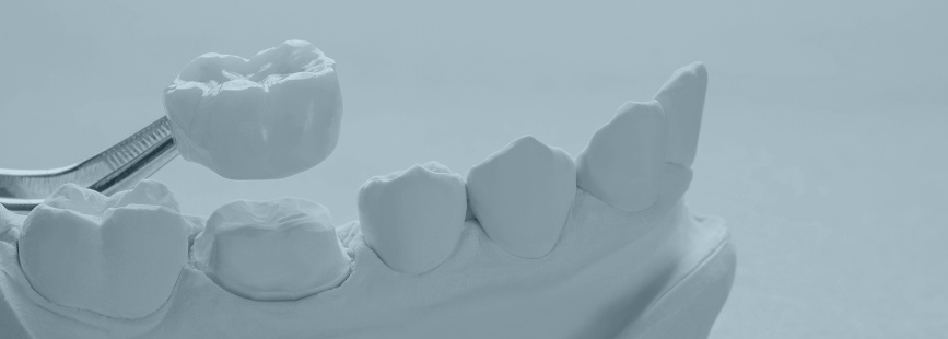 Fiksna protetika IDentE