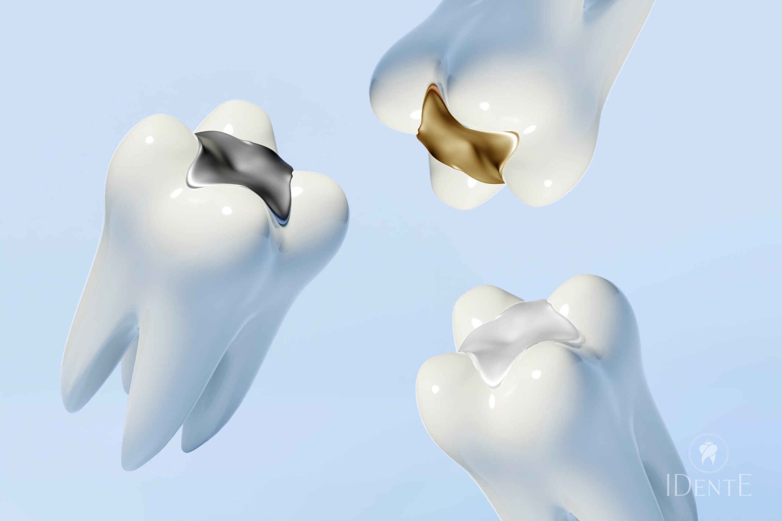 Amalgamske plombe in zakaj jih odstraniti - IDentE