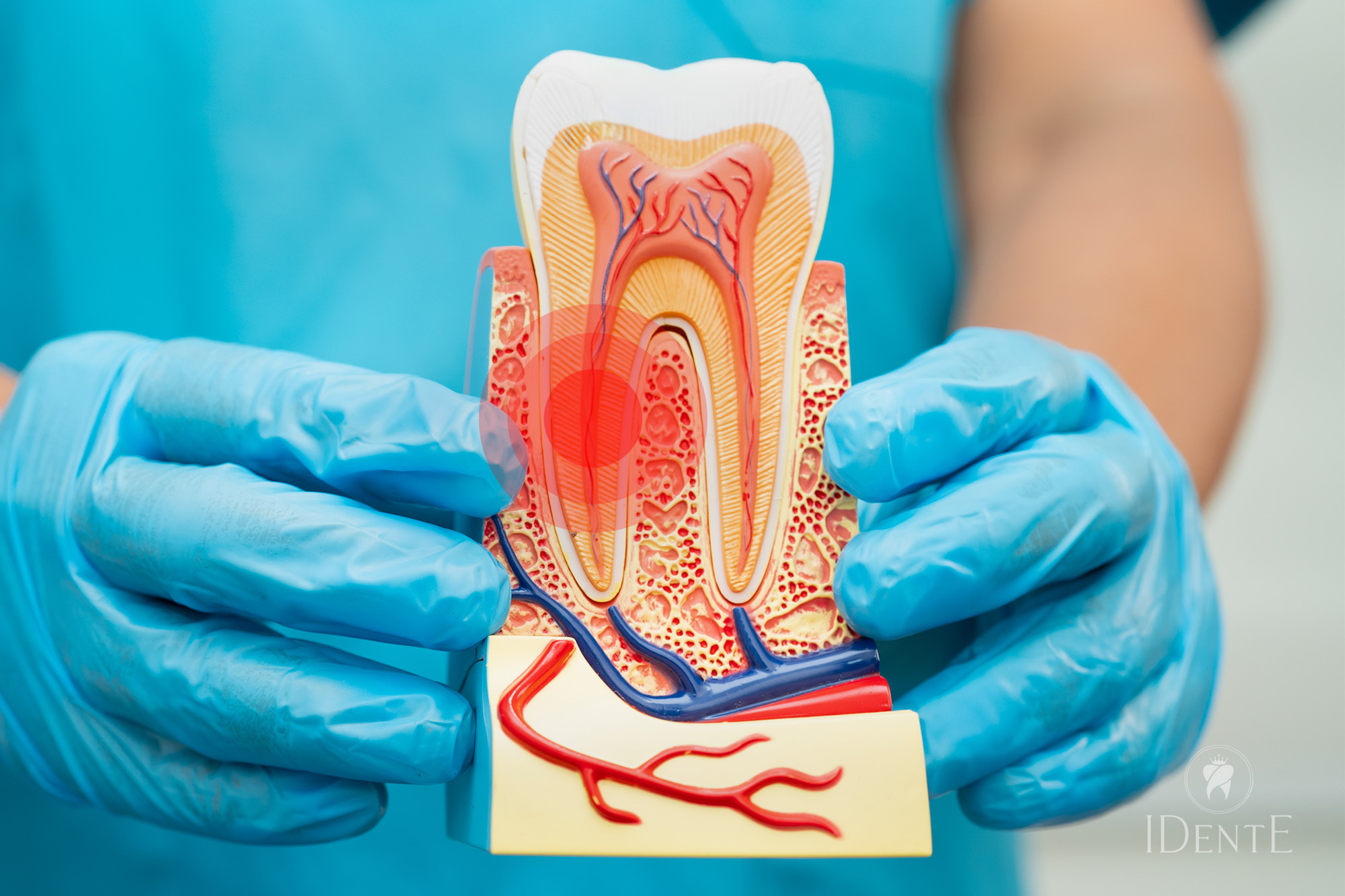 Endodontsko zdravljenje z Reciprocom: Prednosti strojne obdelave koreninskih kanalov