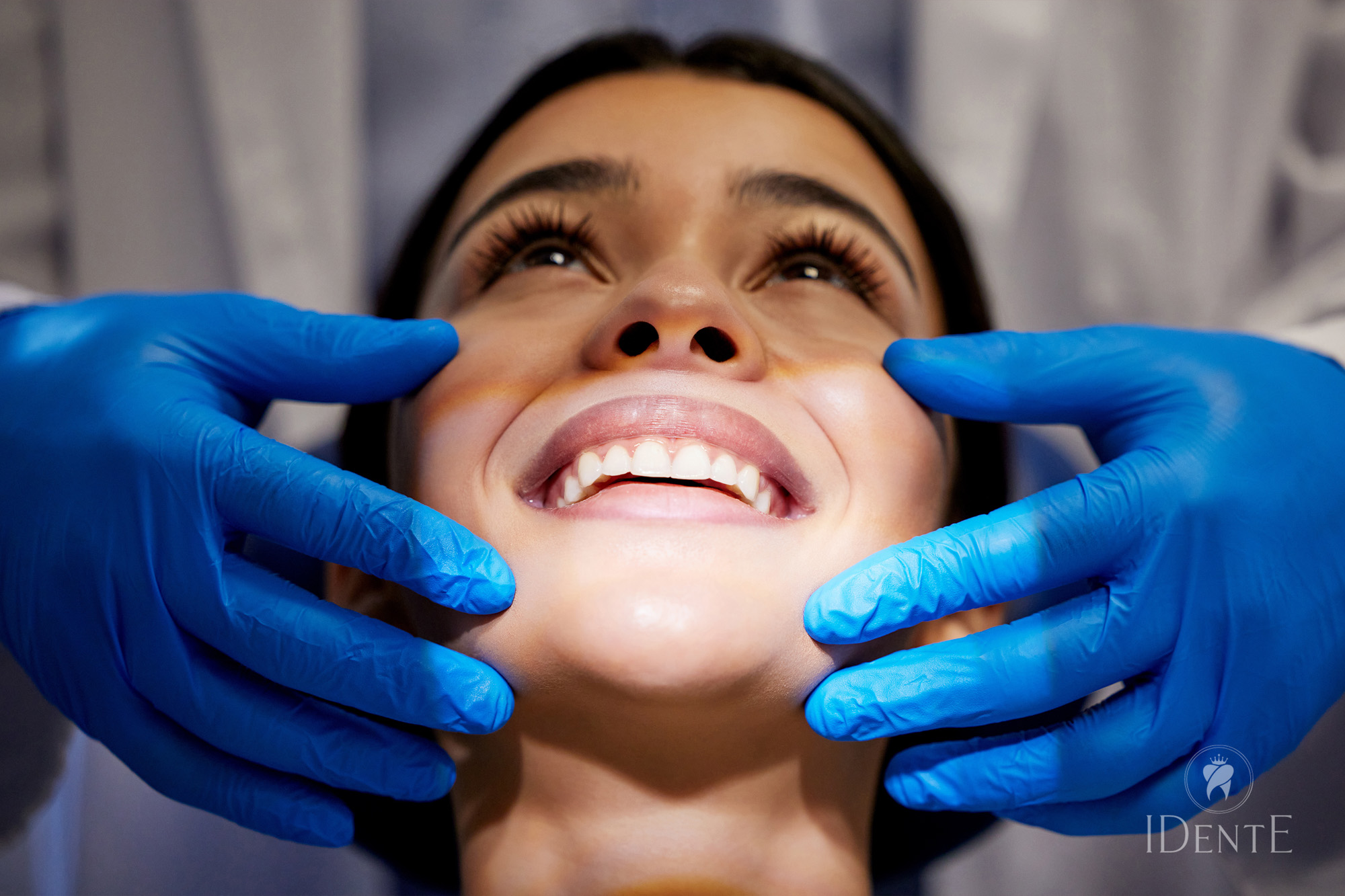 Gummy Smile operacija | 4 metode zdravljenja